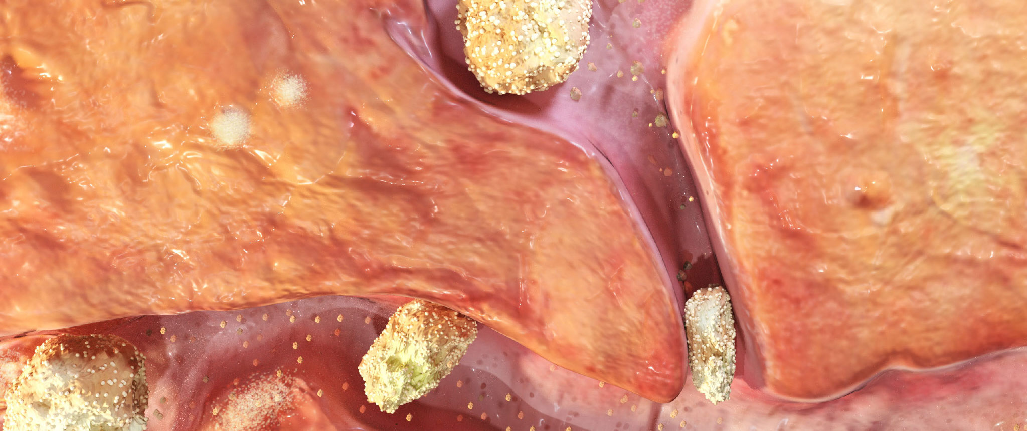 chronic banner mobile